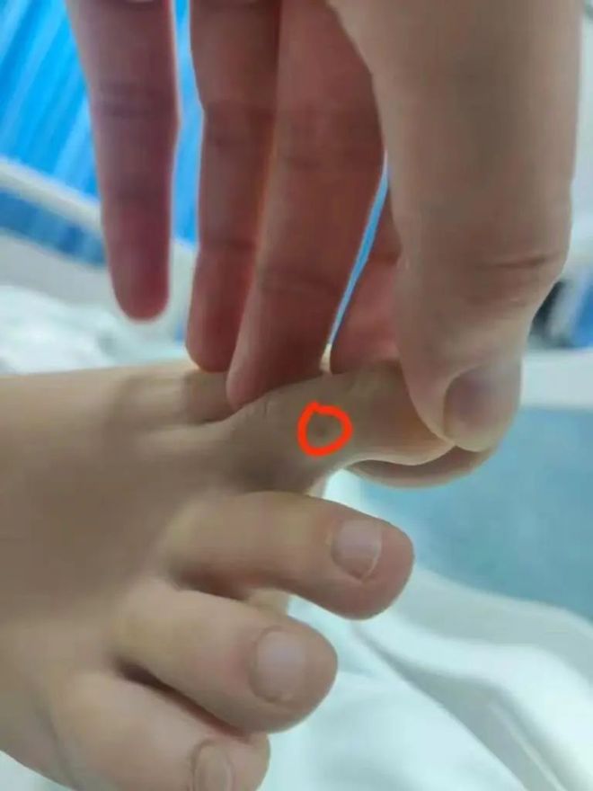 家属质疑医院延误救治！当地卫健委介入！AG真人平台app女子三亚疑被蛇咬身亡(图4)